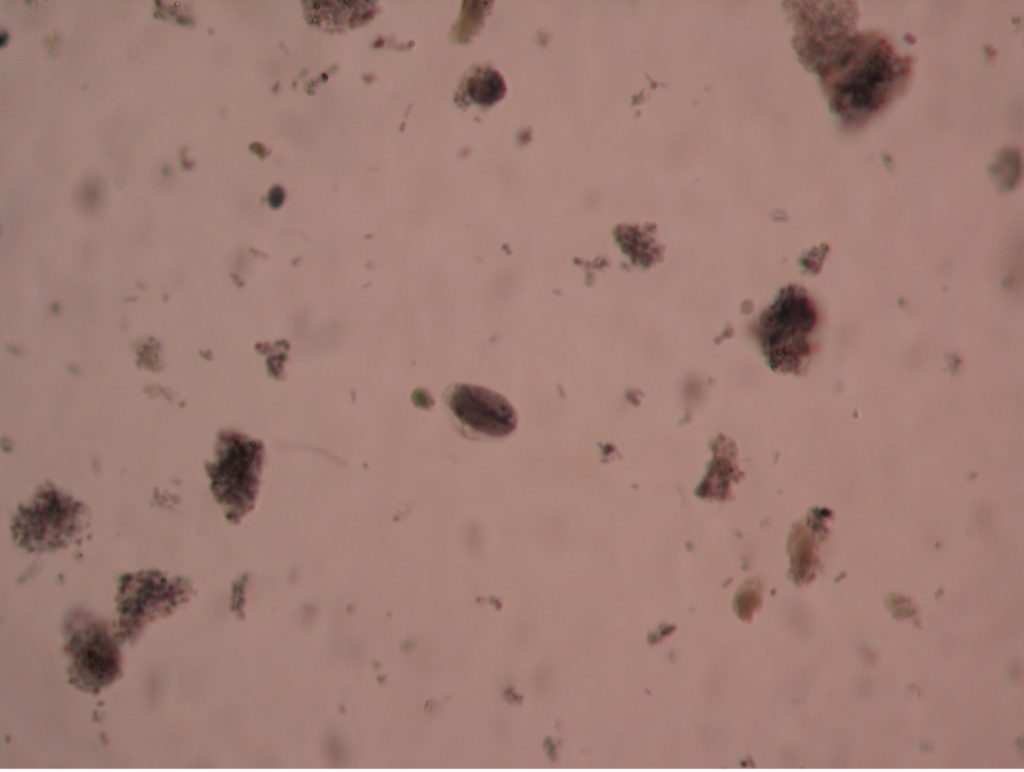 PARASITES PROTOZOA Red Mountain Microbiology