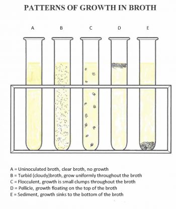 Aseptic Technique Hands On Microbiology