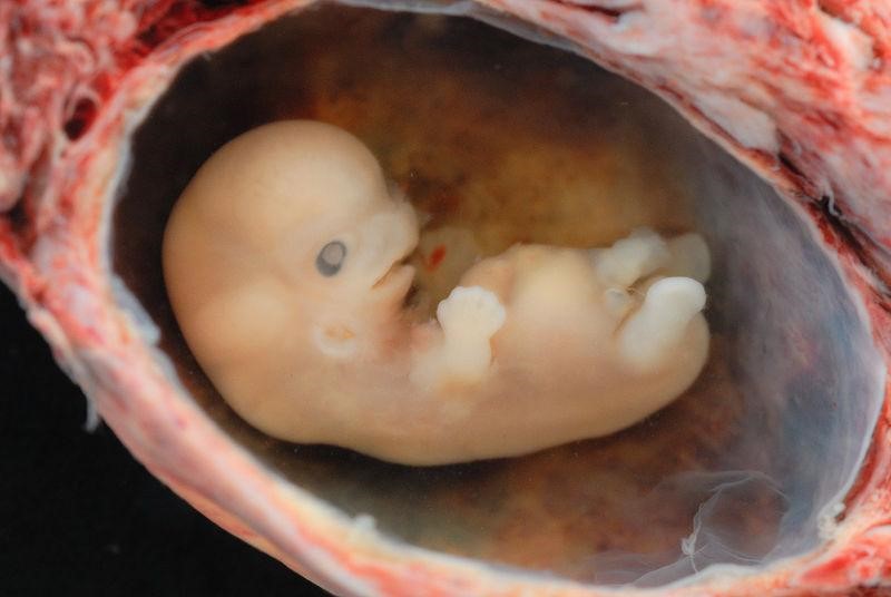 A photo of a human fetus.