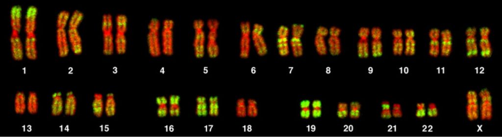 This image shows a full set of twenty-three pairs of chromosomes. Chromosomes one through twenty-two are the autosomes, and the chromosomes at the bottom right show the pairing for a biological female (XX) at conception. (credit: