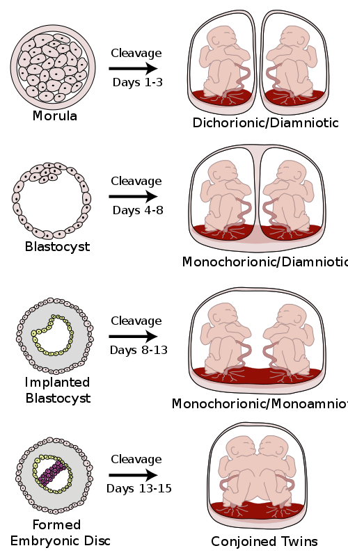 Cellular changes for different types of twins