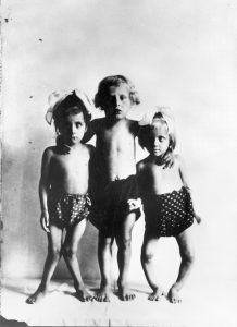 Children with rickets