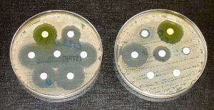 Photo shows two Petri dishes covered with bacteria. The left dish has many areas where bacteria have been killed by antibiotics. The right has fewer areas with dead bacteria.