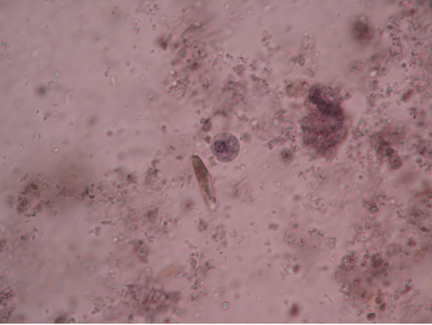 Photo of Entamoeba histolytica cyst