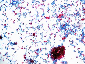 ACID-FAST STAIN – Red Mountain Microbiology