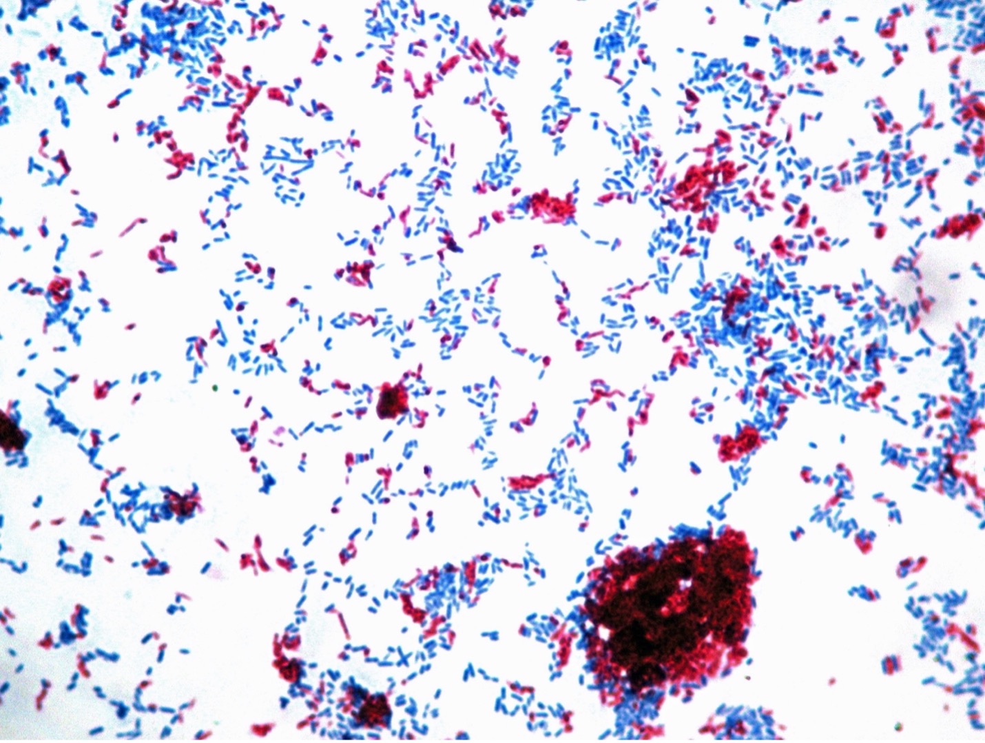 mycobacterium tuberculosis acid fast stain