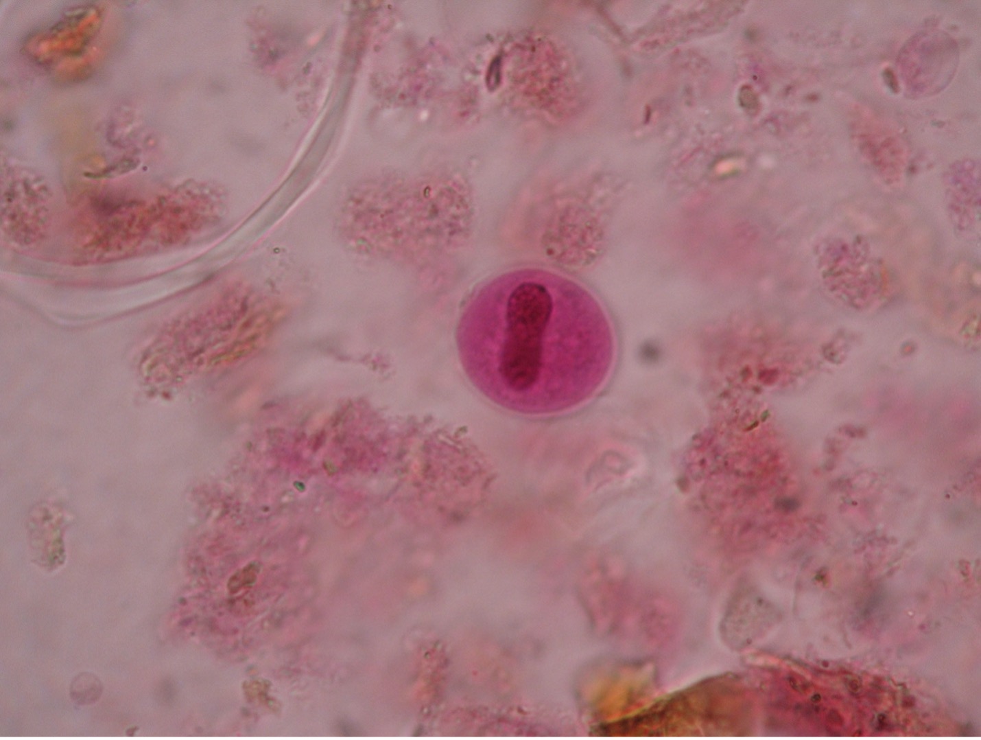 Photo of Balantidium coli cyst
