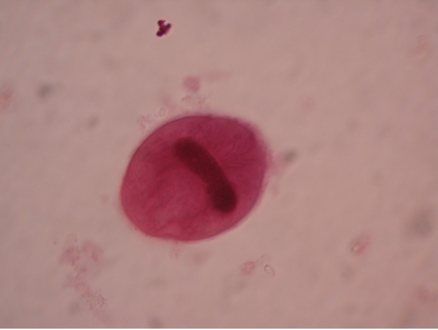Photo of Balantidium coli trophozoite