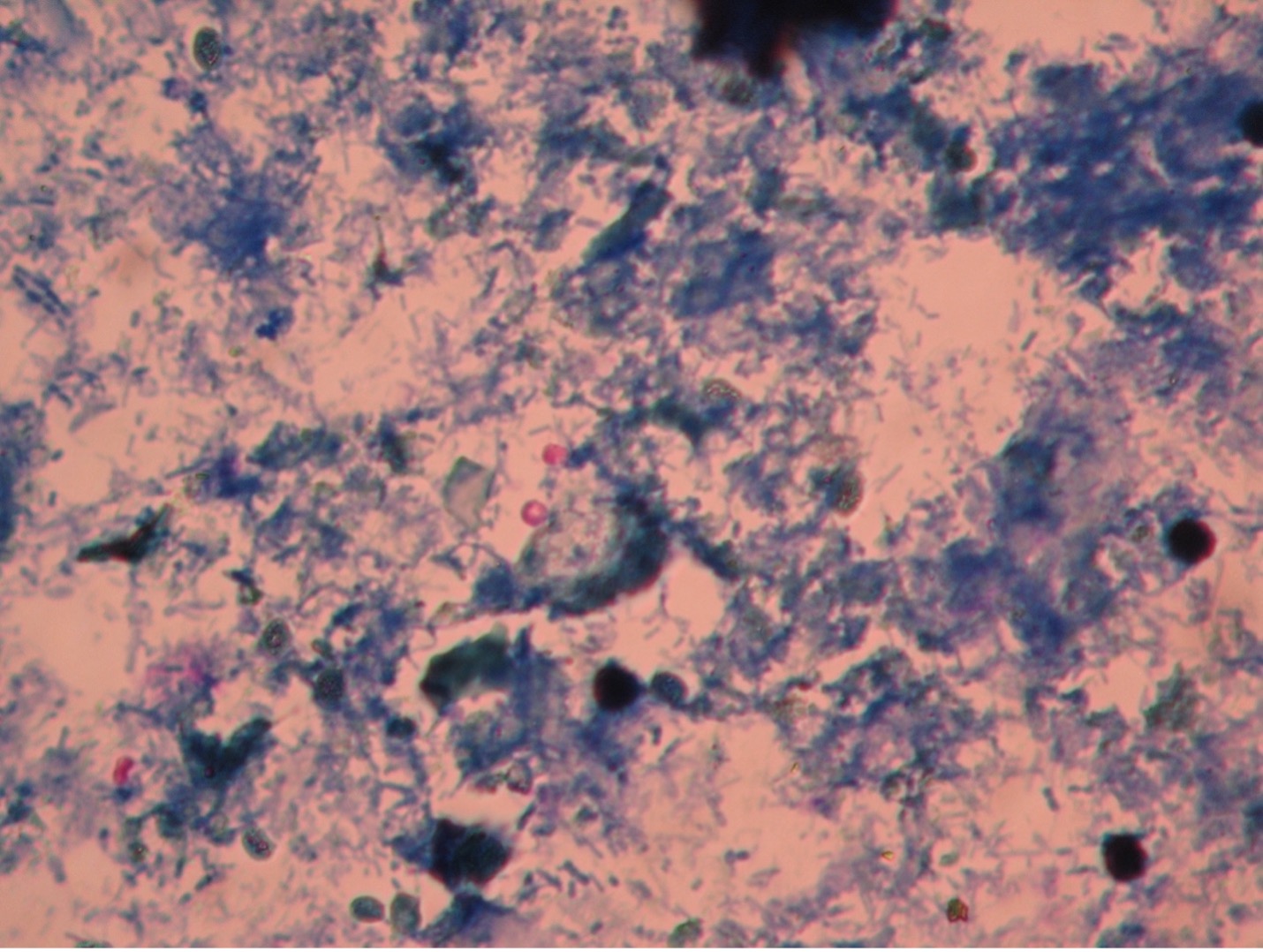 Photo of Cryptosporidium parvum oocyst
