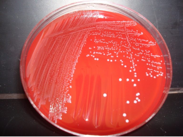 ALPHA AND BETA HEMOLYTIC STREPTOCOCCUS – Red Mountain Microbiology