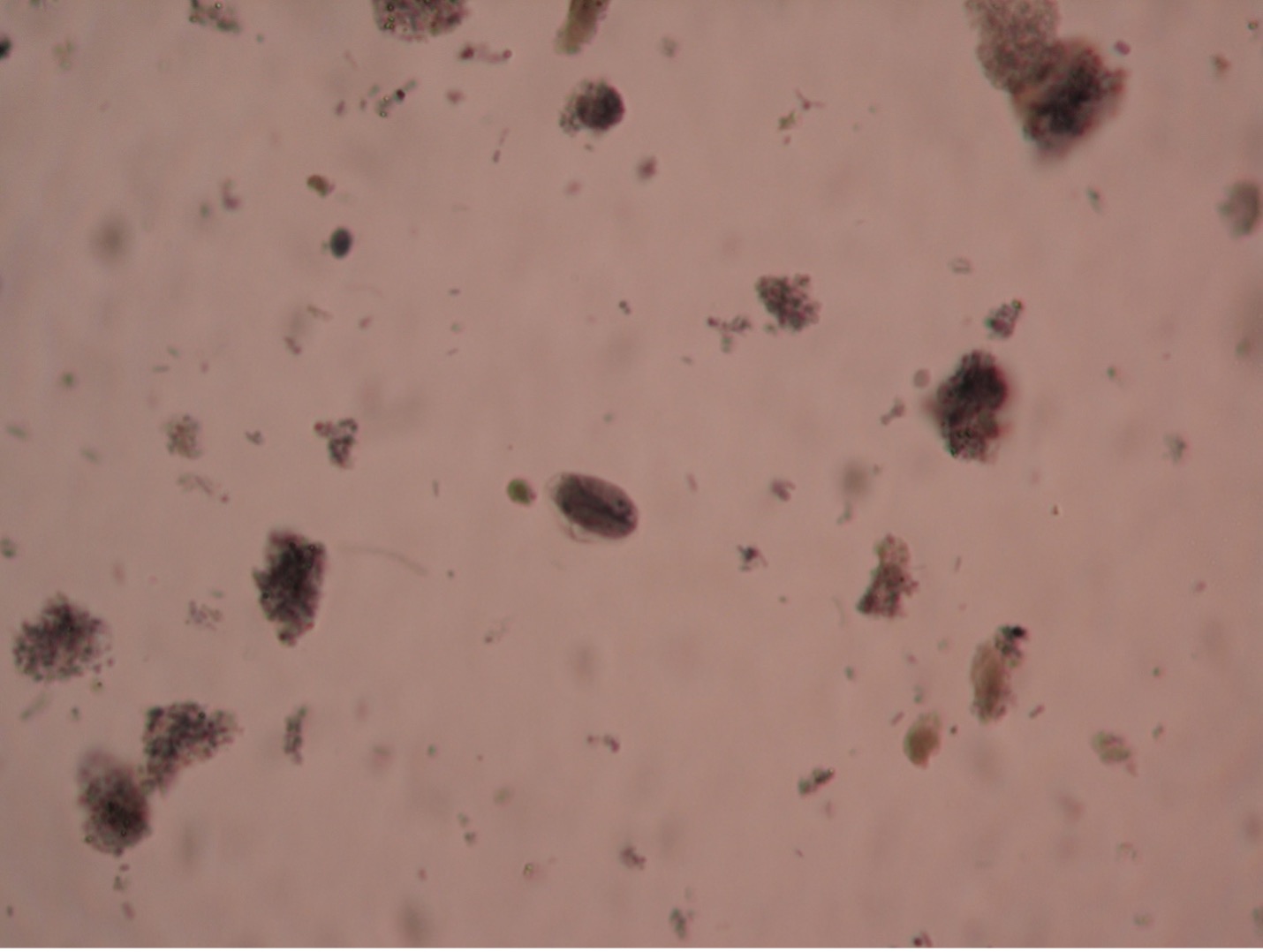Photo of Giardia lamblia cyst