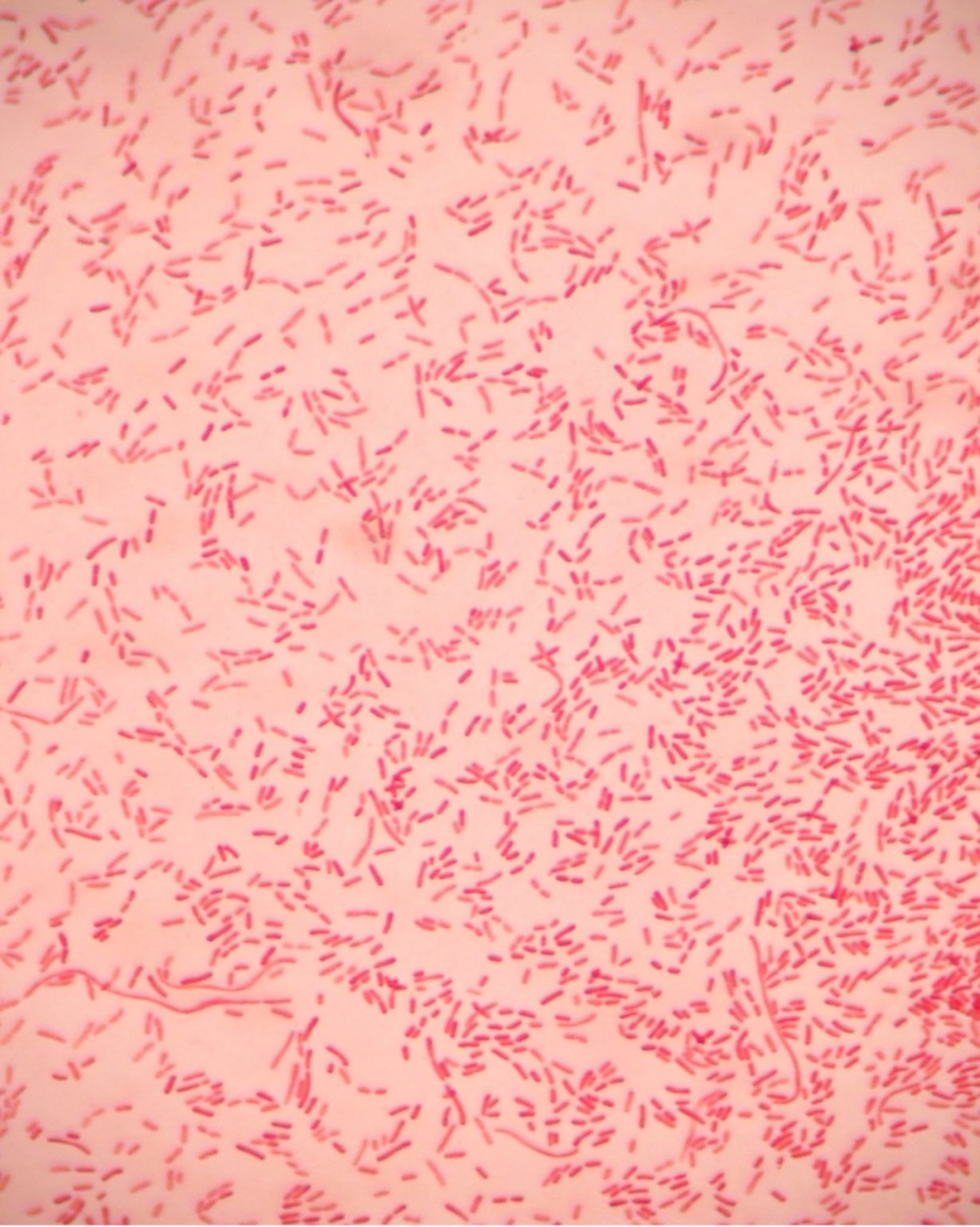 gram-stain-red-mountain-microbiology