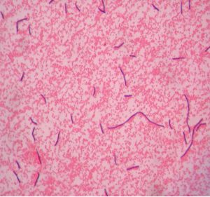 GRAM STAIN – Red Mountain Microbiology