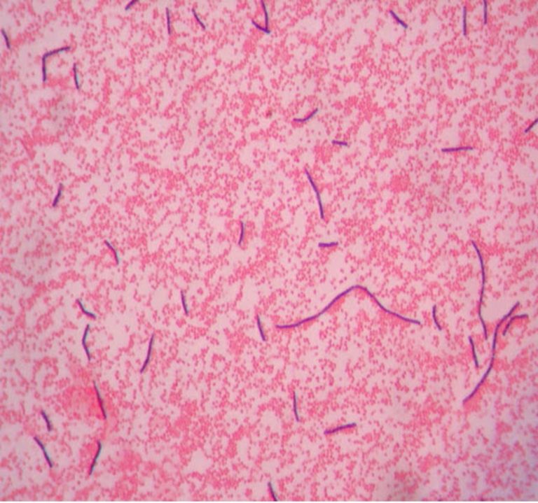 gram-stain-red-mountain-microbiology