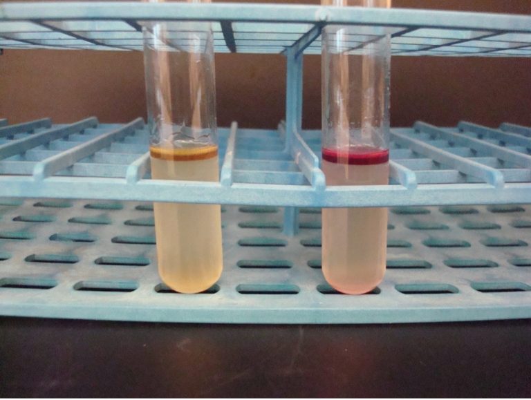 IDENTIFICATION OF ENTEROBACTERIACEAE Red Mountain Microbiology