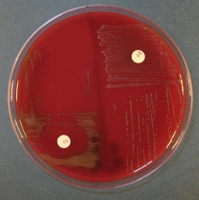 Inhibition of growth around the disk = Positive = Sensitive Bacterial growth up to the disk = Negative = Resistant