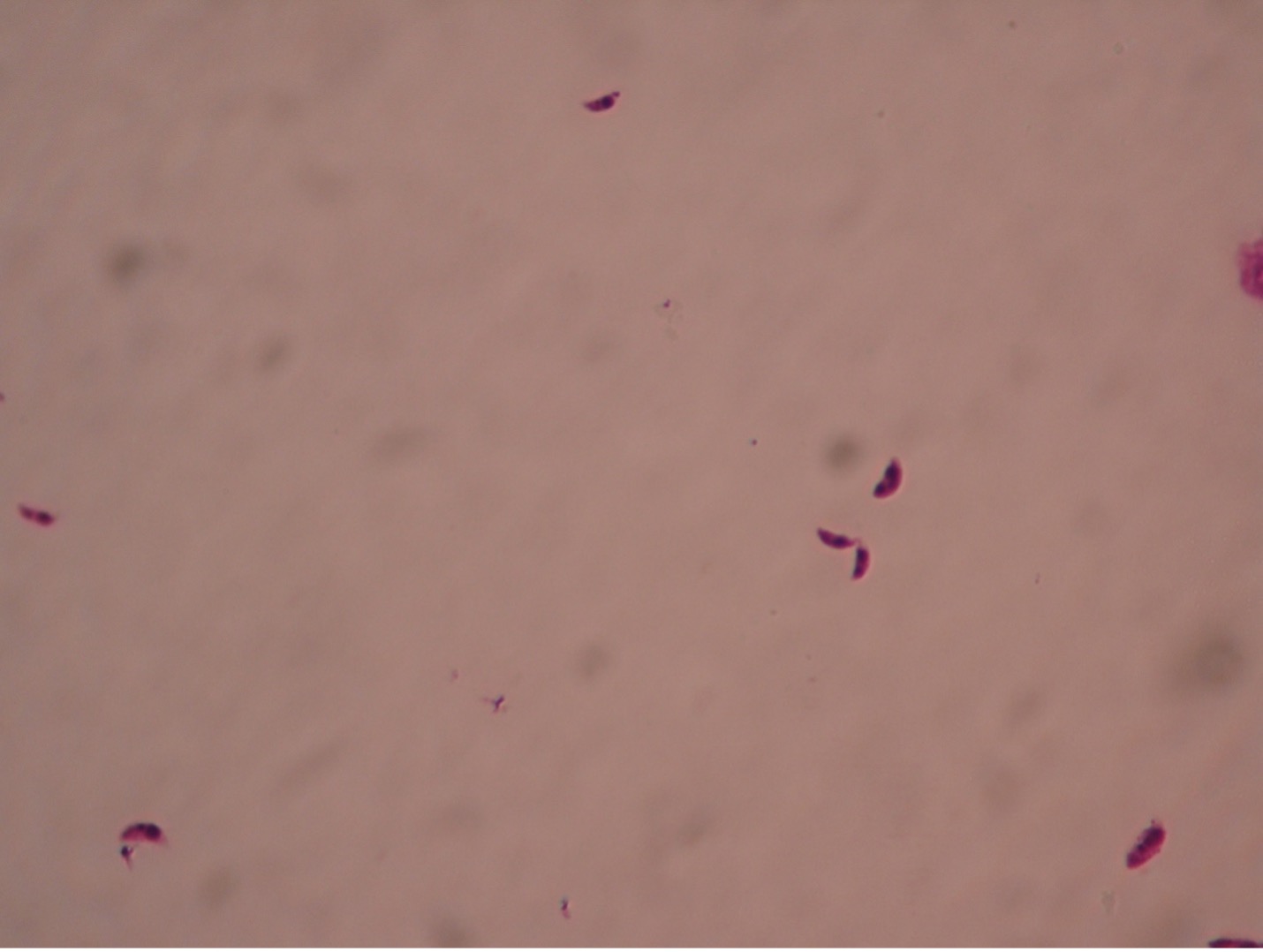 Photo of Toxoplasma gondii trophozoites