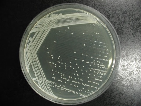 staphylococcus epidermidis streak plate