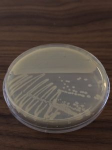 Photo of E. coli Streak Plate