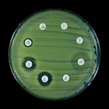 KIRBY-BAUER TEST – Hands On Microbiology