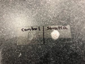 Photo of catalase test results