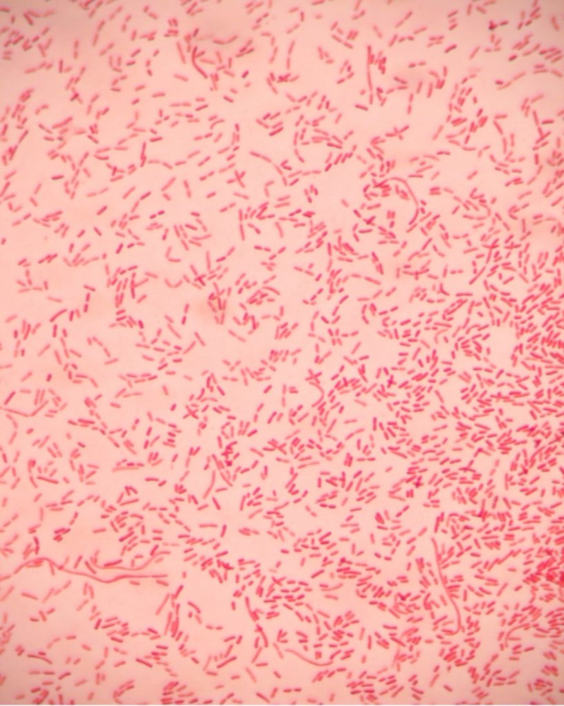 Gram-negative bacilli