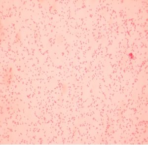 VIRTUAL GRAM STAIN AND MICROSCOPE – Hands On Microbiology