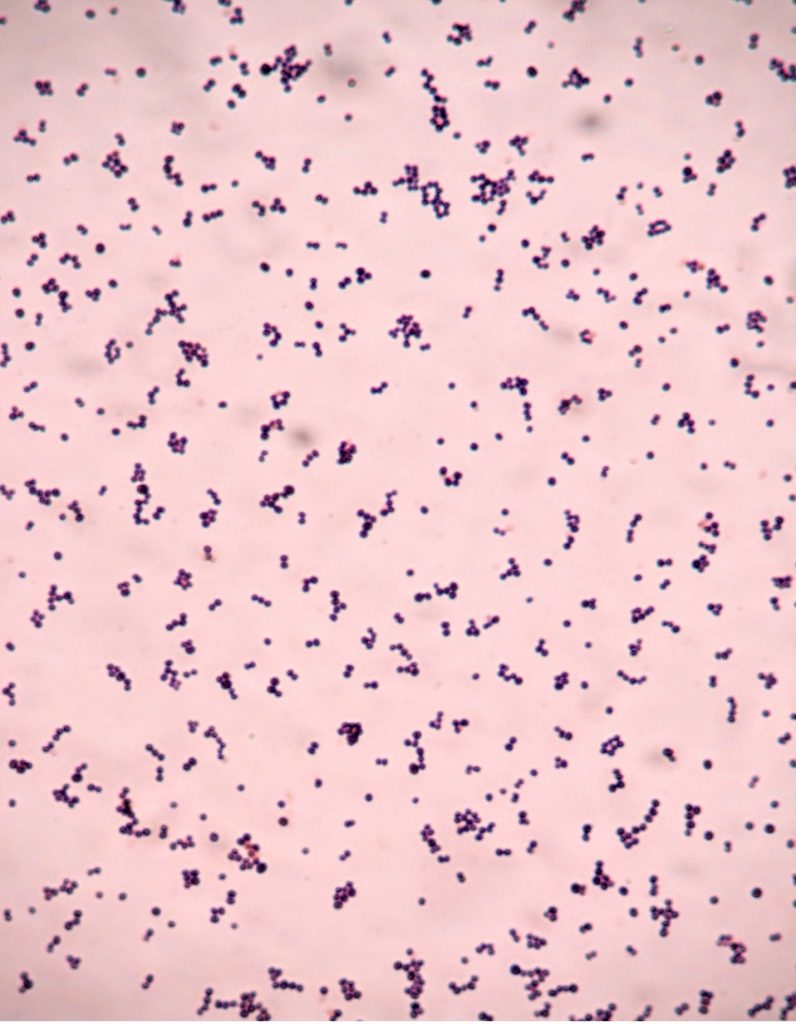 Gram-positive cocci