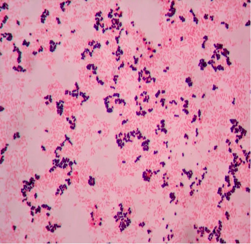 Gram positive cocci and Gram negative bacilli