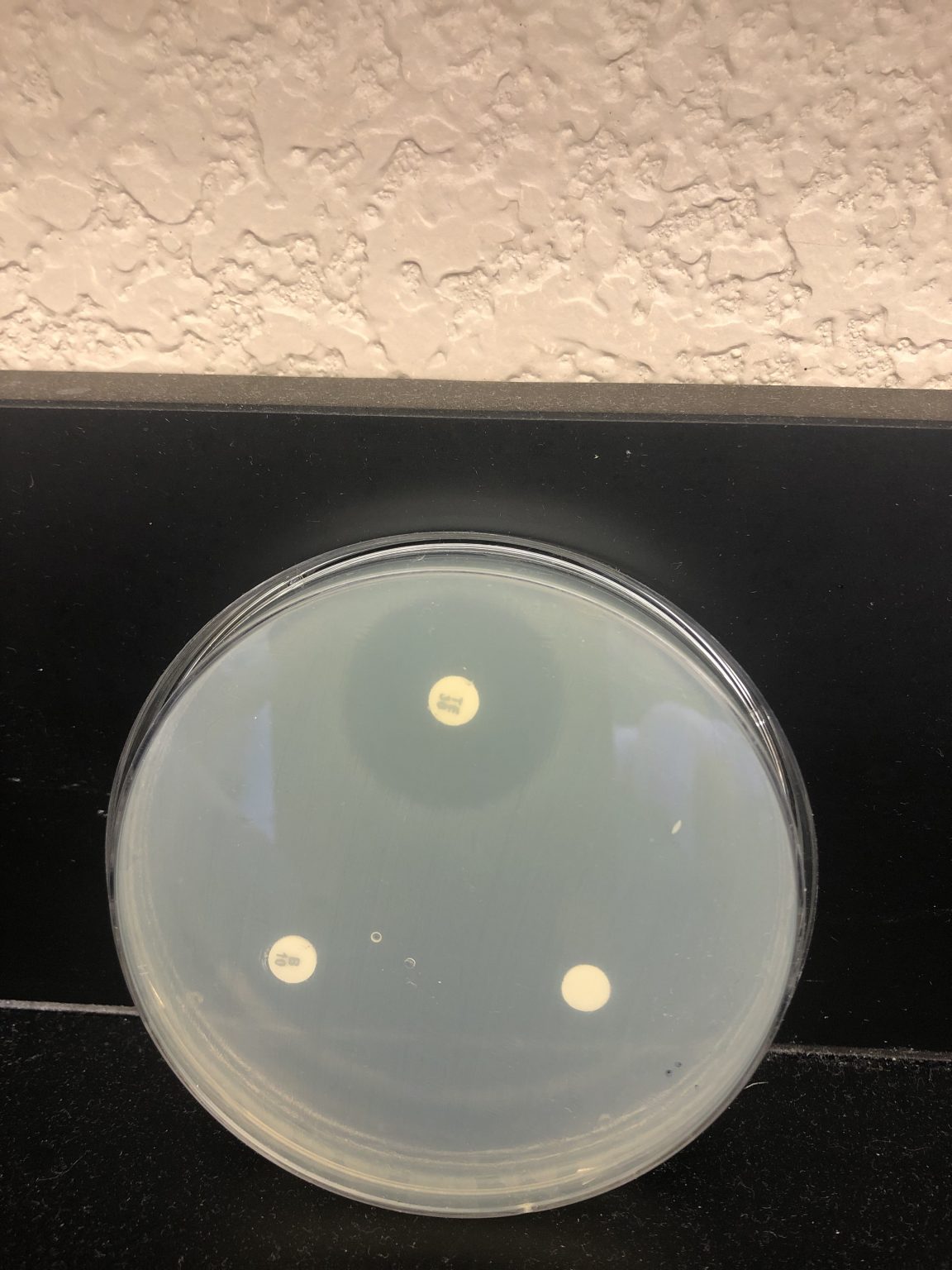 KIRBY-BAUER TEST – Hands On Microbiology