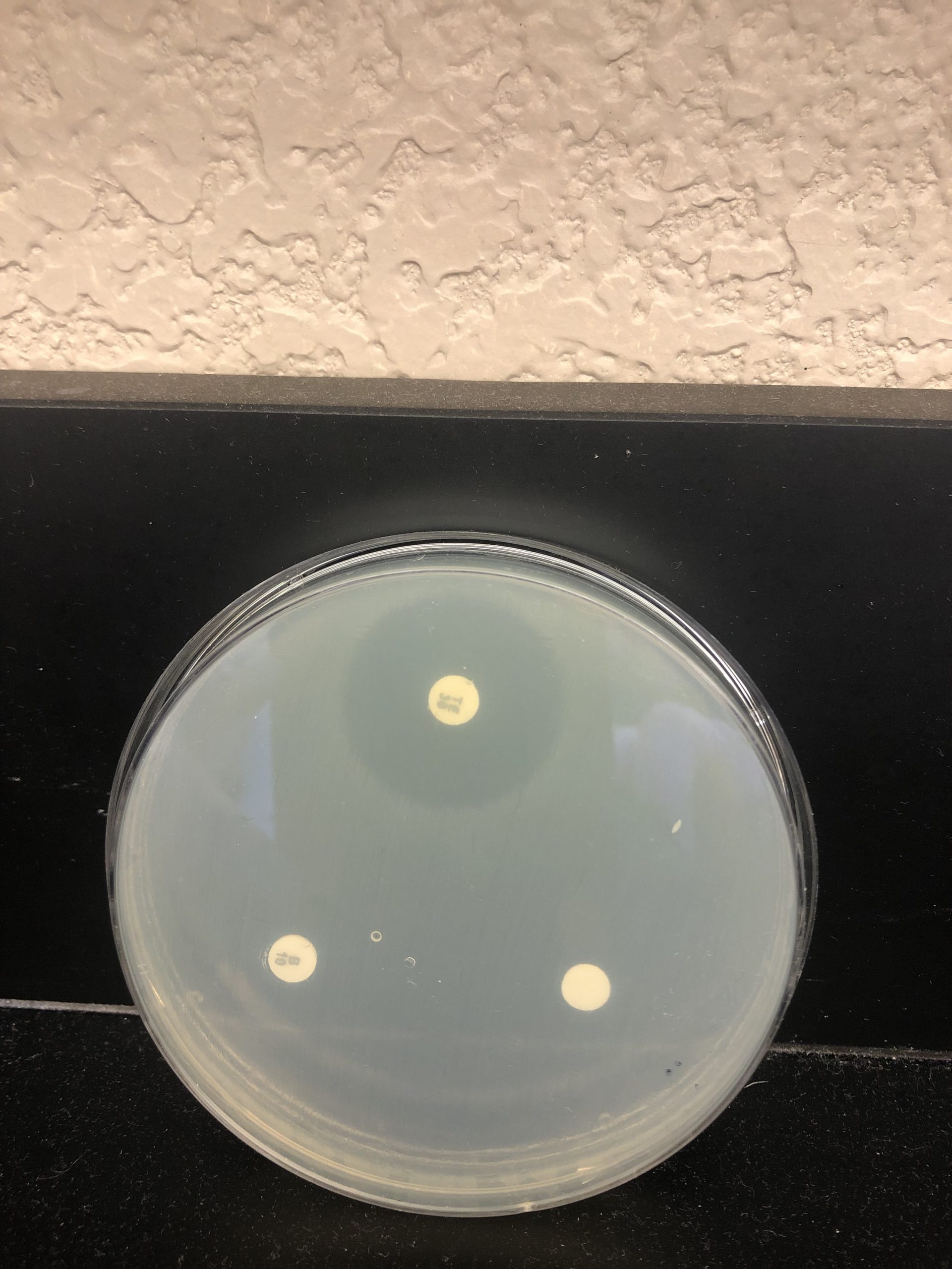 KIRBYBAUER TEST Hands On Microbiology