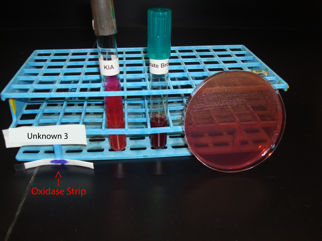 Gram negative unknown 3