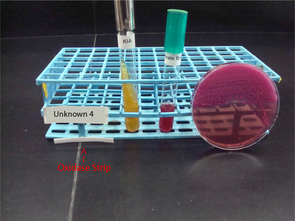 Gram negative unknown 4