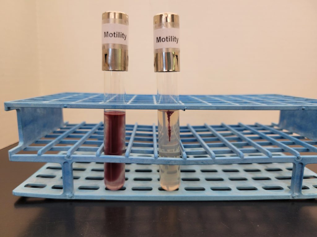 Motility agar test results