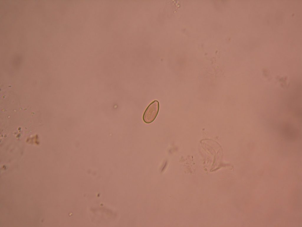 Clonorchis sinensis ovum