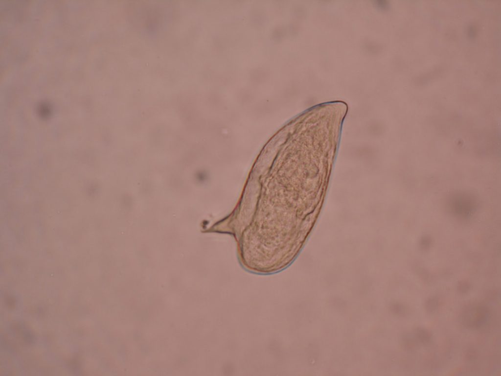 Schistosoma mansoni ovum