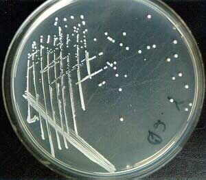 Image of Staphylococcus epidermidis colonies