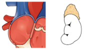 Cardiovascular System – Blood Vessels and Blood – Building a Medical