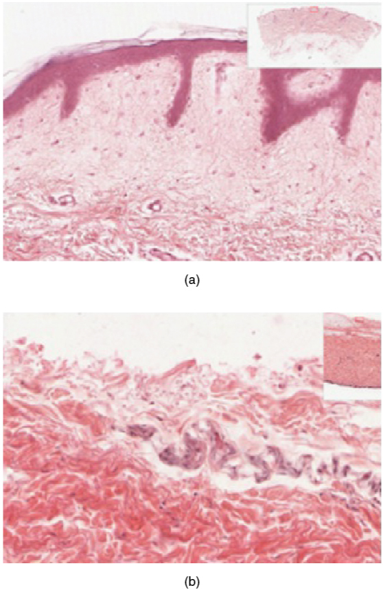 Thin skin versus thick skin in photographs. Image description available.