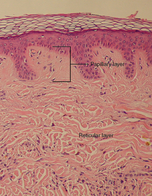 Layers of the dermis. Image description available.