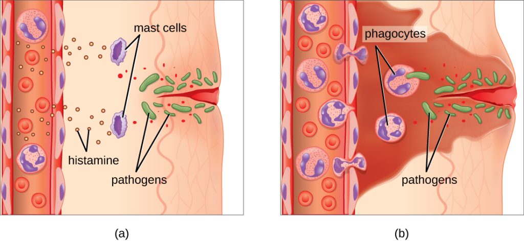 Image showing inflammatory response, with labels