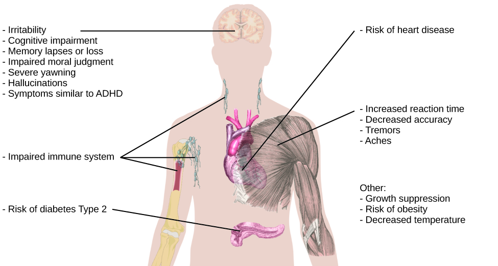 An illustration of the top half of a human body identifies the locations in the body that correspond with various adverse affects of sleep deprivation. The brain is labeled with “Irritability,” “Cognitive impairment,” “Memory lapses or loss,” “Impaired moral judgment,” “Severe yawning,” “Hallucinations,” and “Symptoms similar to ADHD.” The heart is labeled with “Risk of heart disease.” The muscles are labeled with “Increased reaction time,” “Decreased accuracy,” “Tremors,” and “Aches.” There is an organ near the stomach labeled “Risk of diabetes Type 2.” Various parts of the neck, arm, and underarm are labeled “Impaired immune system.” Other risks include “Growth suppression,” “Risk of obesity,” “Decreased temperature.”