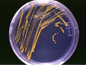 Image of Petri plate