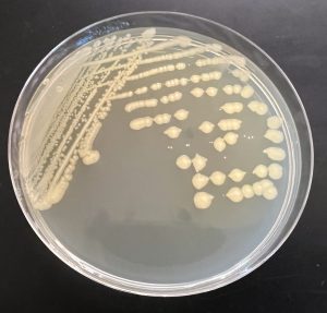 Traditional Method Mixed Culture Streak Plate. Note the two different colony types.