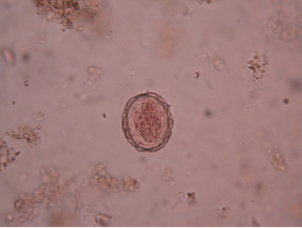 Ascaris lumbricoides ovum