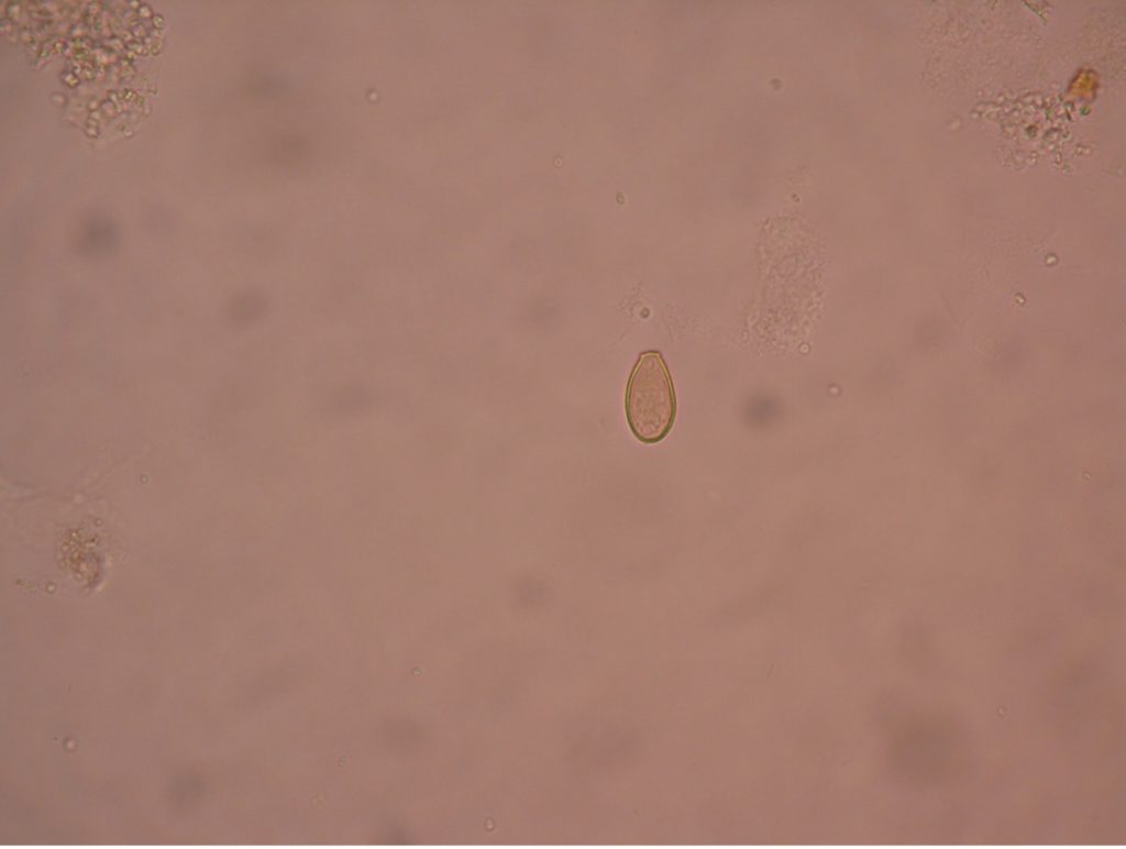 Clonorchis sinensis ovum