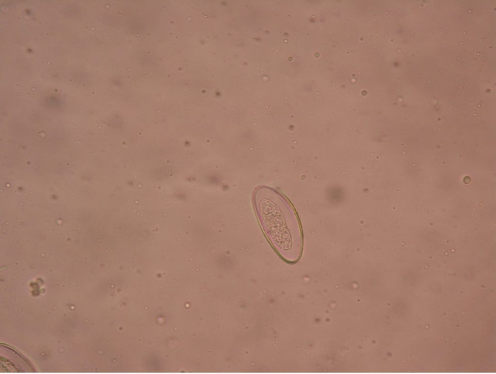 Enterobius vermicularis ovum