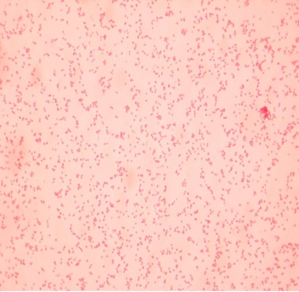 GRAM STAIN Laboratory Exercises in Microbiology