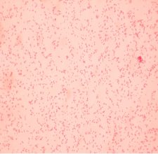 GRAM STAIN – Laboratory Exercises in Microbiology