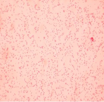 GRAM STAIN – Laboratory Exercises in Microbiology